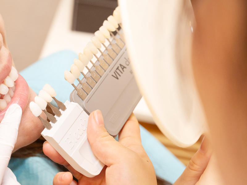 審美治療で求める美しさ